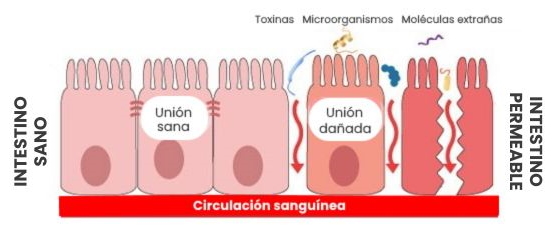 hiperpermeabilidad intestinal